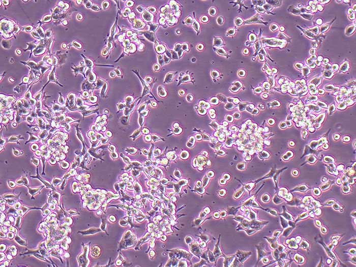 U14小鼠子宫颈癌细胞（STR鉴定正确）