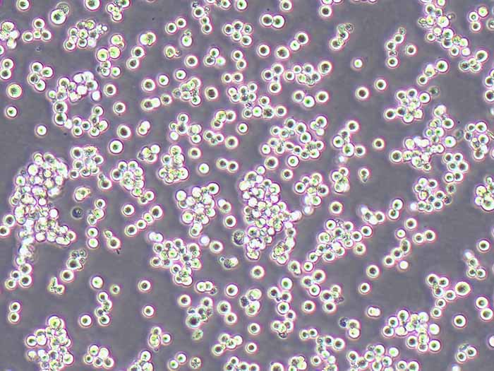 LLC-WRC 256大鼠腹水癌细胞