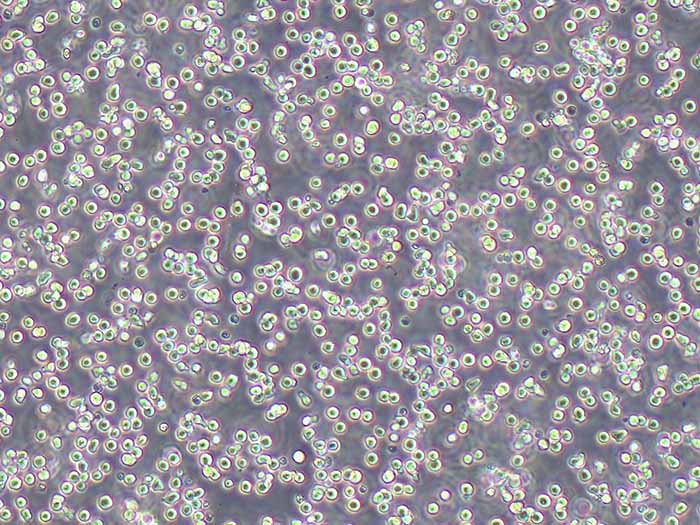 RAMOS人B淋巴细胞瘤细胞（STR鉴定正确）
