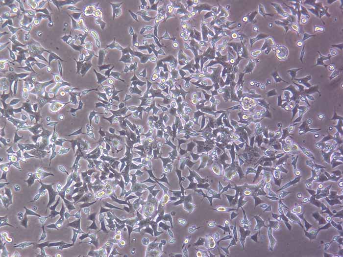 C666-1人鼻咽癌细胞株（STR鉴定正确）