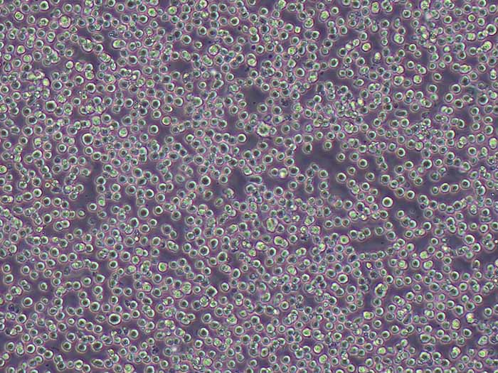 THP-1人单核细胞白血病细胞（STR鉴定正确）