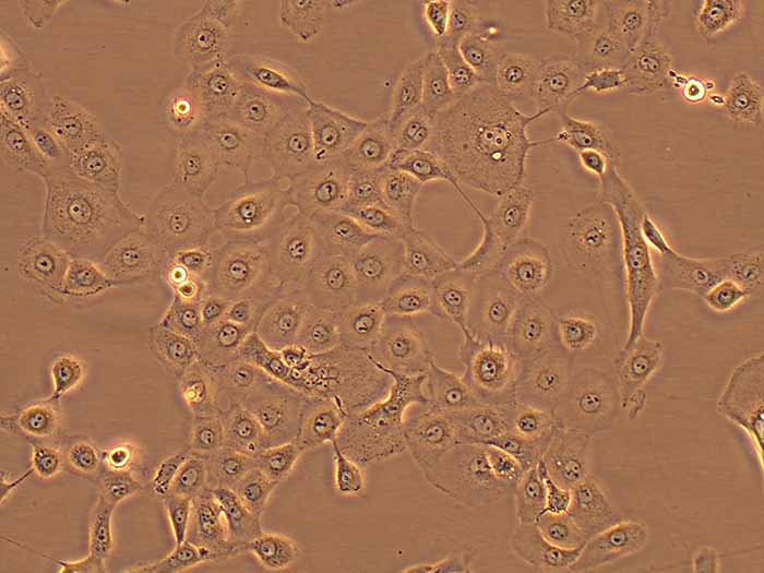 NCI-H1650人非小细胞肺癌细胞（STR鉴定正确）