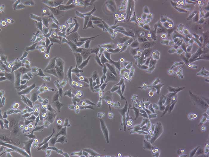 SK-HEP-1人肝窦内皮细胞（STR鉴定正确）
