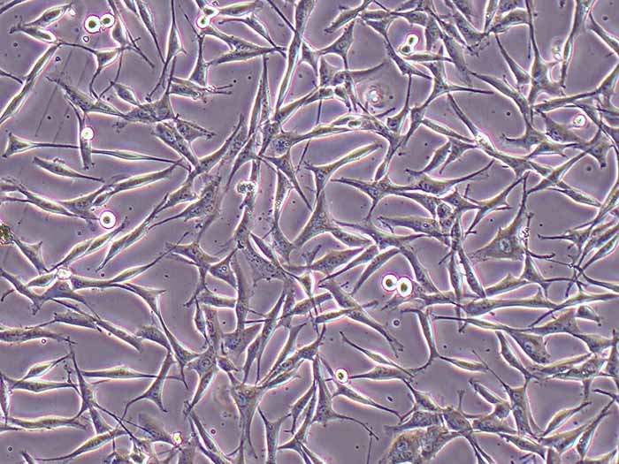 WM-115人恶性黑色素瘤细胞（STR鉴定正确）