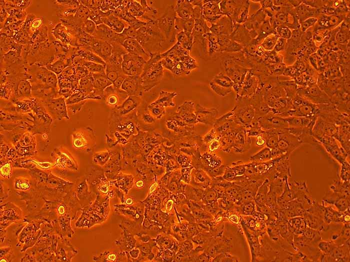 BHT101人甲状腺癌细胞