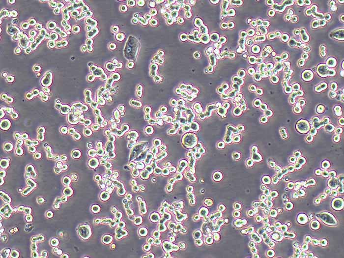 COLO 320DM人结直肠腺癌细胞（STR鉴定正确）