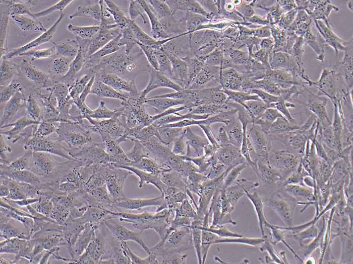 A172人胶质母细胞瘤细胞（STR鉴定正确）