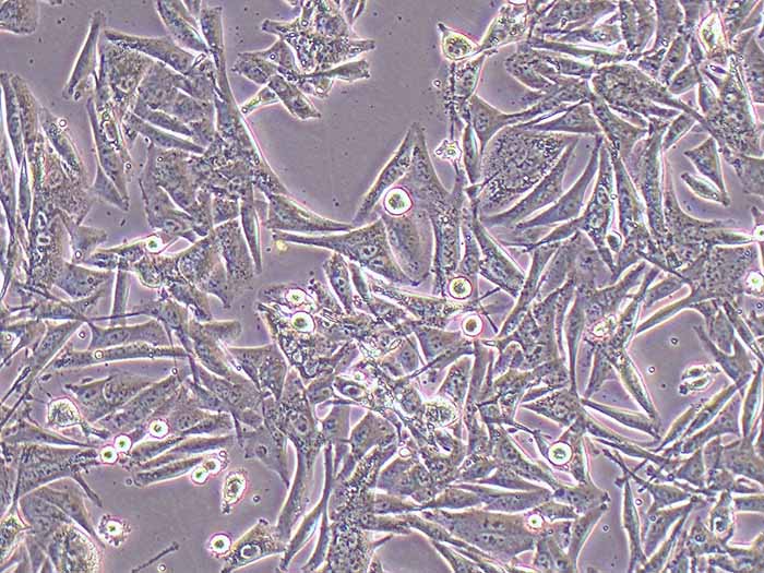 SK-MEL-5人皮肤恶性黑色素瘤细胞（STR鉴定正确）