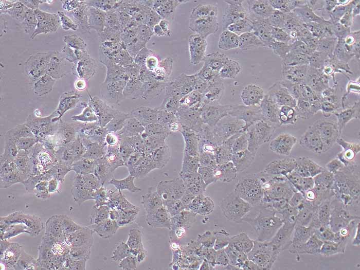 MCF-7/ADR人乳腺癌阿霉素耐药细胞株