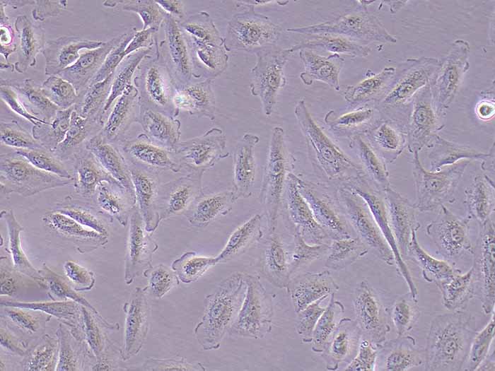 A498人肾透明细胞癌（STR鉴定正确）