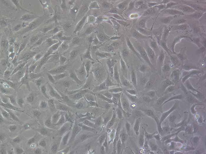 786-O人肾透明细胞腺癌细胞（STR鉴定正确）