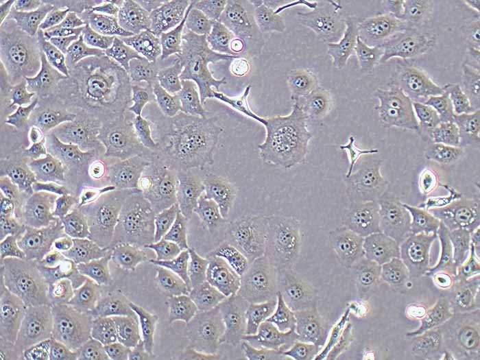 kyse30人食道癌细胞（STR鉴定正确）