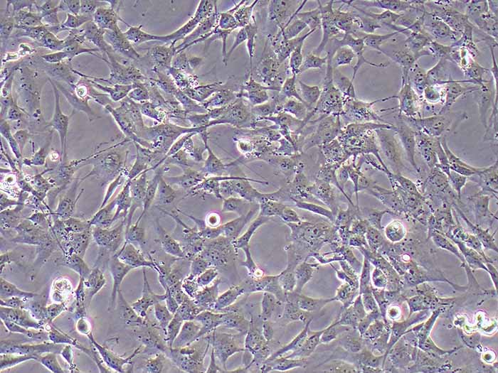 HRCEC人视网膜微血管内皮细胞（暂不提供）