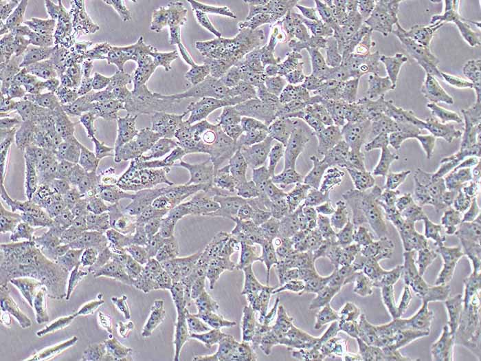 NCI-H157人非小细胞肺腺癌细胞（STR鉴定正确）