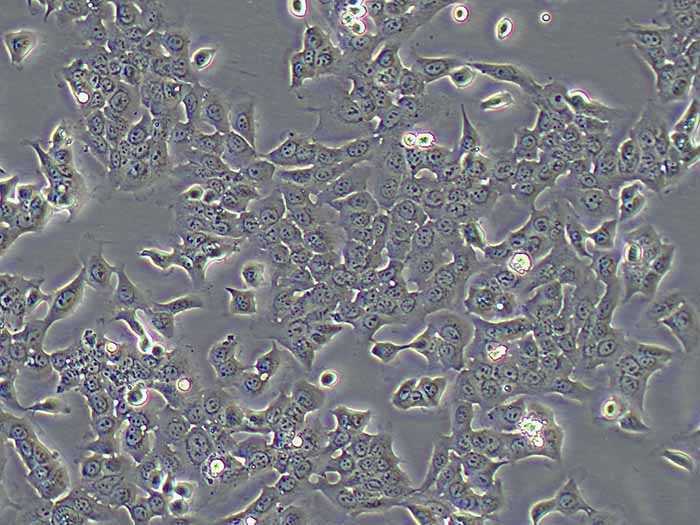 HPAC人胰腺癌细胞（STR鉴定正确）