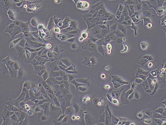 PLC/PRF/5人肝癌亚力山大细胞（STR鉴定正确）