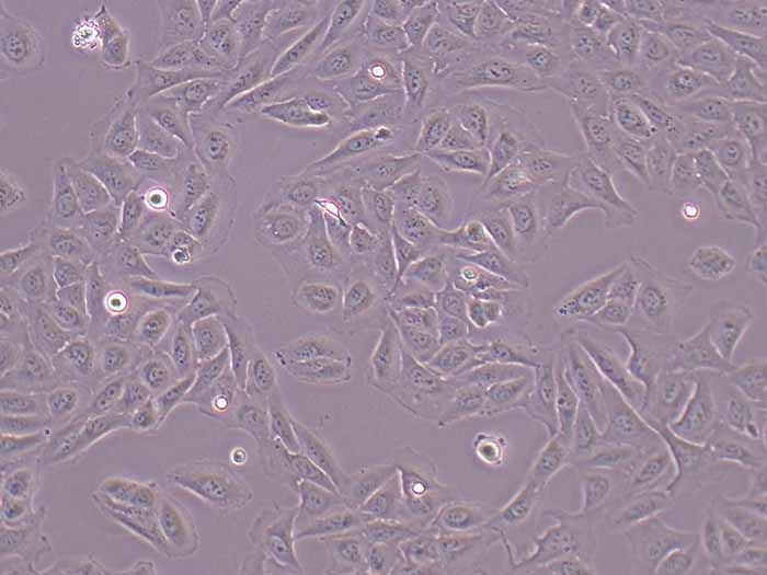 U2OS人骨肉瘤细胞（STR鉴定正确）