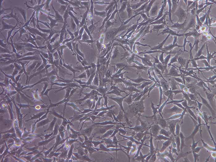 HEY人卵巢癌细胞（STR鉴定正确）