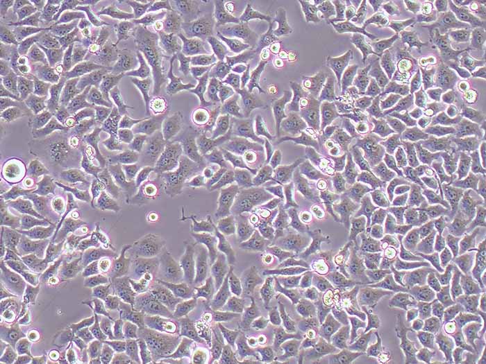 BT-B人膀胱癌细胞（STR鉴定正确）
