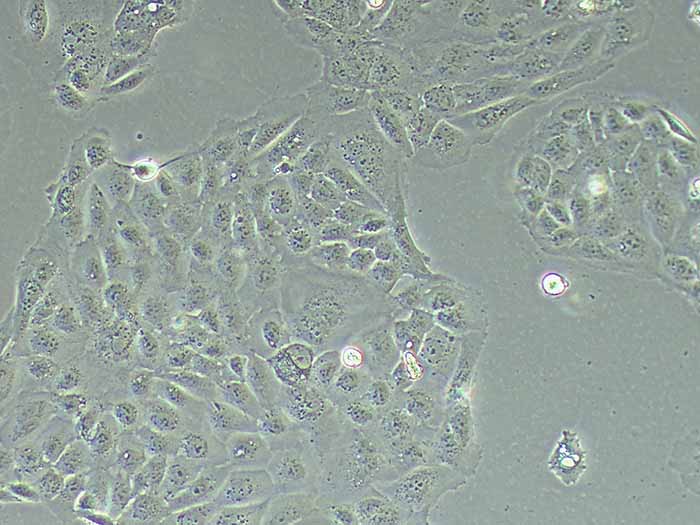 PANC10.05人胰腺癌细胞（STR鉴定正确）