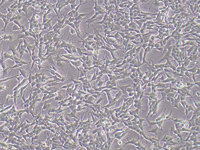 SH-SY5Y人神经母细胞瘤细胞（STR鉴定正确）
