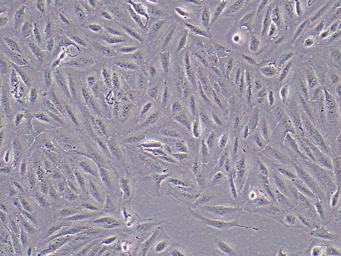 ARPE-19人视网膜色素上皮细胞（STR鉴定正确）