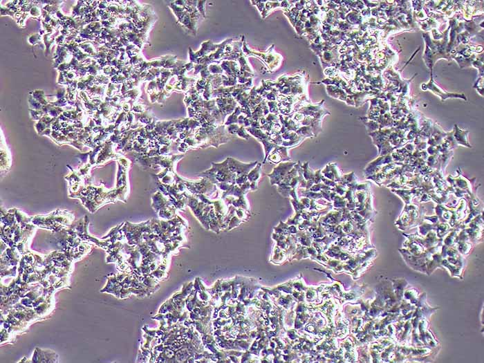BETA-TC-6小鼠胰岛素瘤胰岛β细胞