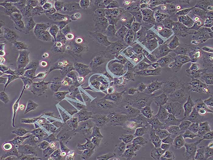BT-549人乳腺管癌细胞（STR鉴定正确）