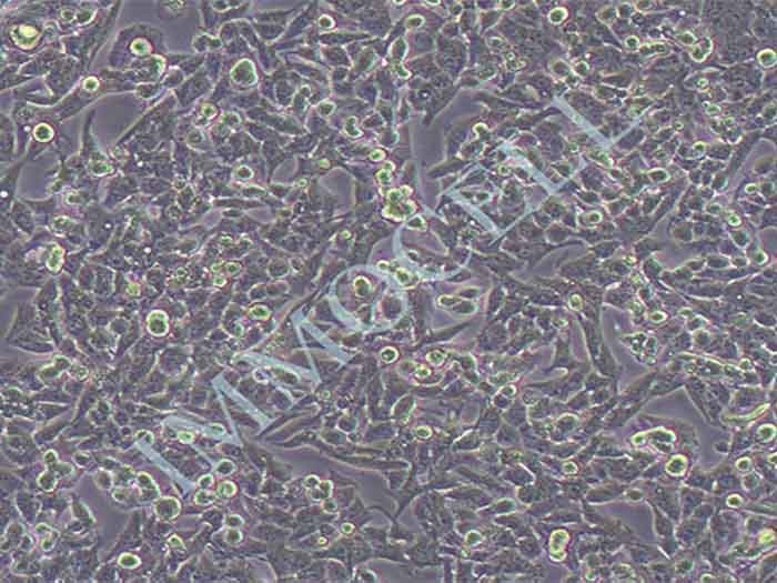 HepG2.2.15人肝癌细胞（STR鉴定正确）