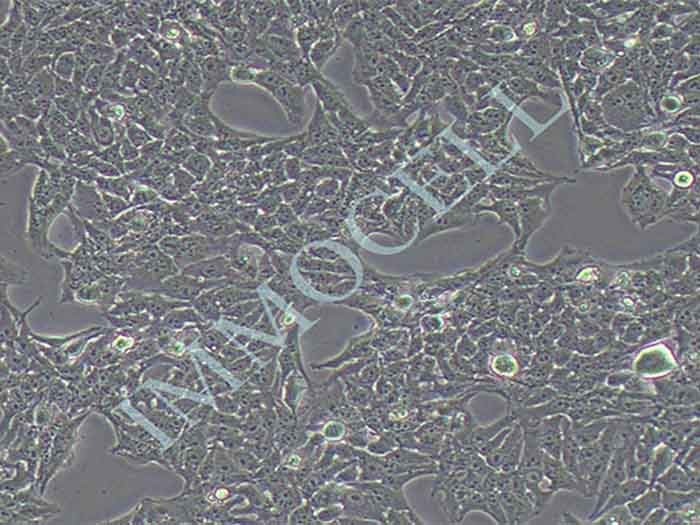 WRL68人正常肝细胞(STR鉴定正确)（Hela污染细胞系,暂不供应）