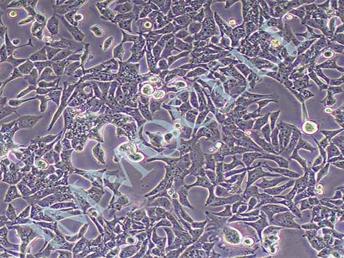 VCaP人前列腺癌细胞（STR鉴定正确）