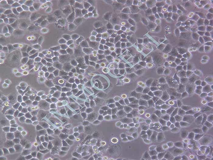 SGC-7901人胃腺癌细胞（STR鉴定正确）（Hela污染细胞系）
