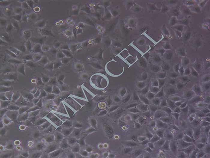 MGC-803人胃癌细胞（STR鉴定正确）（Hela污染细胞系）