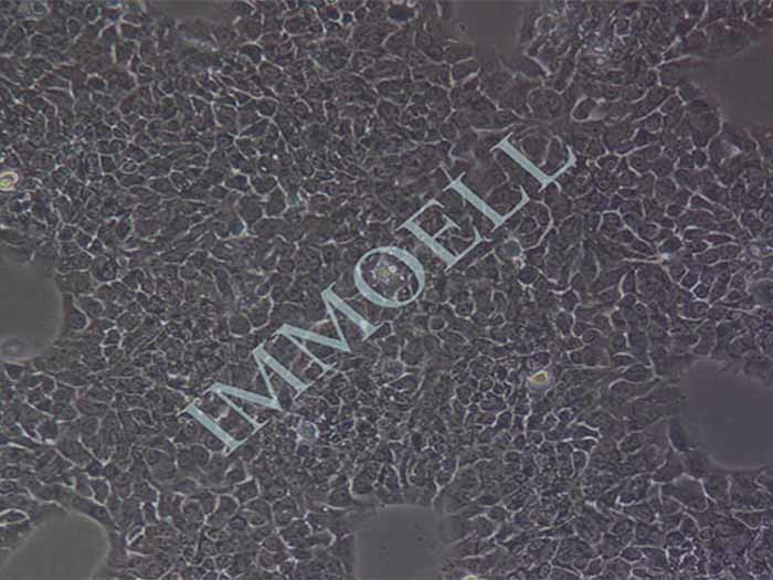 TU212人喉癌细胞（STR鉴定正确）（Hela污染细胞系）