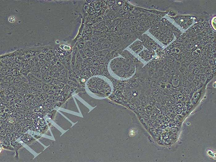 Capan-2人胰腺癌细胞（STR鉴定正确）