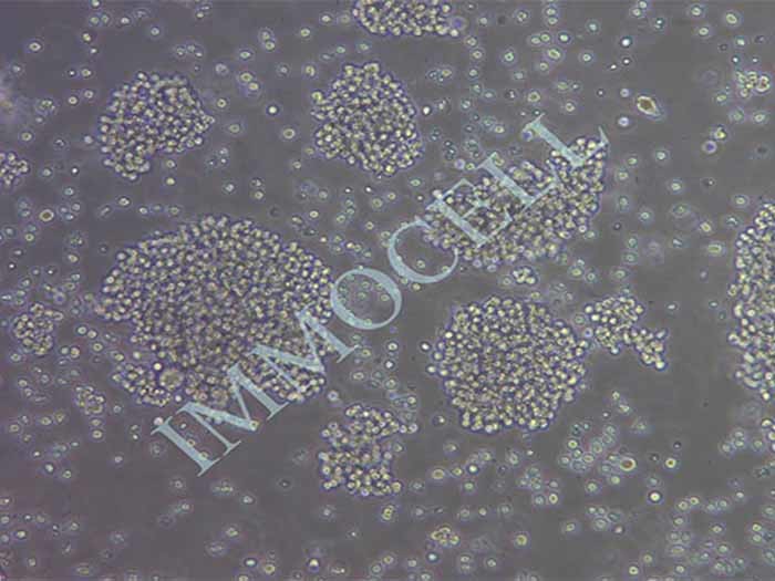 Jurkat Clone E6-1人T淋巴细胞白血病细胞（STR鉴定正确）