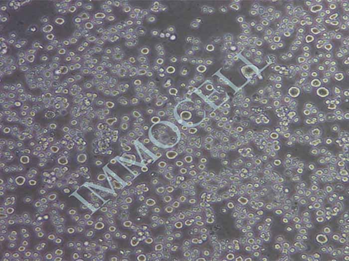 U266人多发性骨髓瘤细胞（STR鉴定正确）