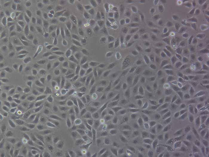5637人膀胱癌细胞