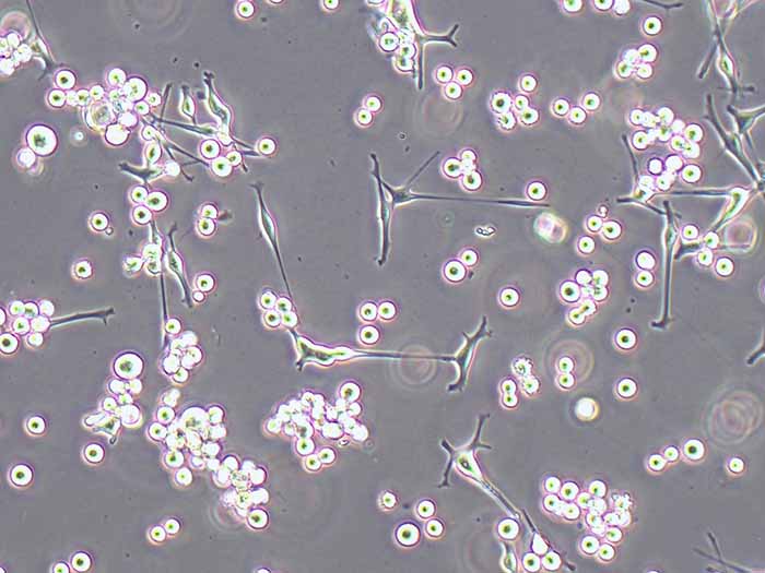 SK-MEL-1人皮肤黑色素瘤细胞（STR鉴定正确）