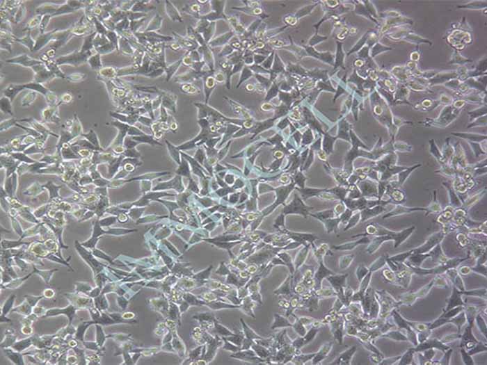 A375人恶性黑色素瘤细胞