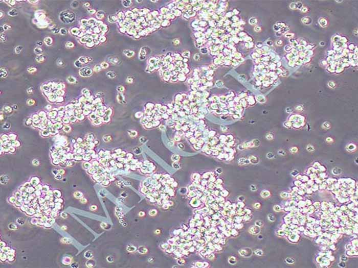J.gamma1人急性T细胞白血病细胞（STR鉴定正确）