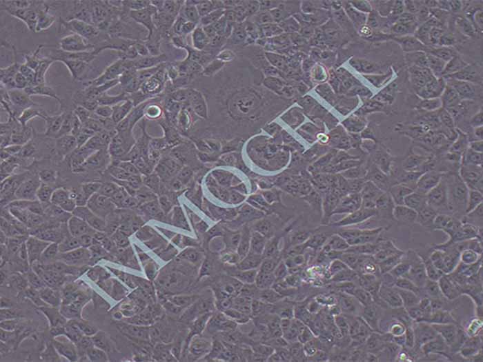 SHEE人食管上皮细胞（永生化）（暂不提供）