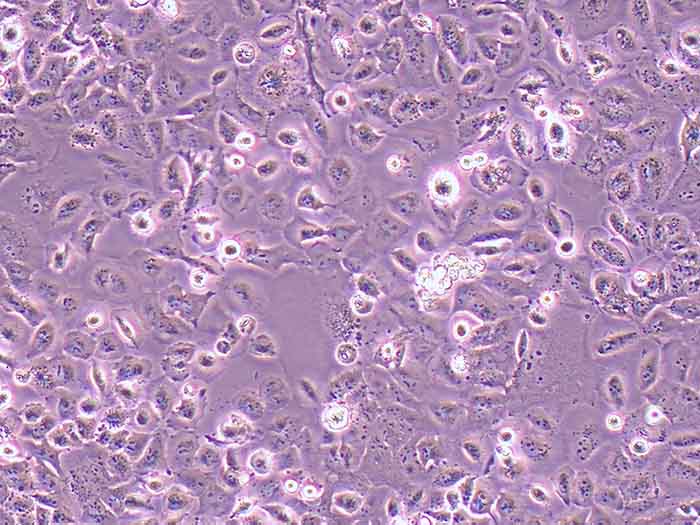 NCI-H23人非小细胞肺癌细胞（STR鉴定正确）