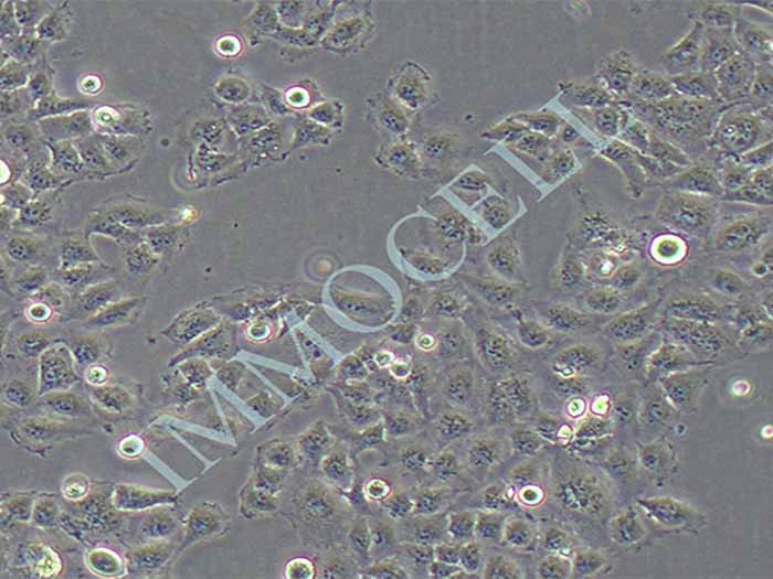 QGY-7701人肝癌细胞