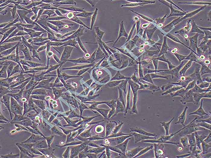 A2058人皮肤癌细胞（STR鉴定正确）