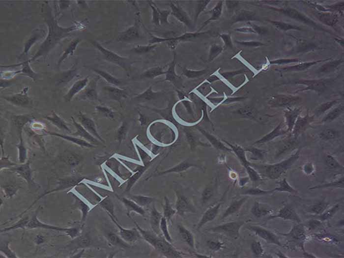 sw982人滑膜肉瘤细胞（STR鉴定正确）