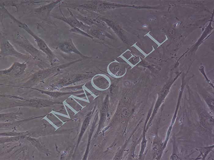 HFLS-RA类风湿关节炎成纤维样滑膜细胞