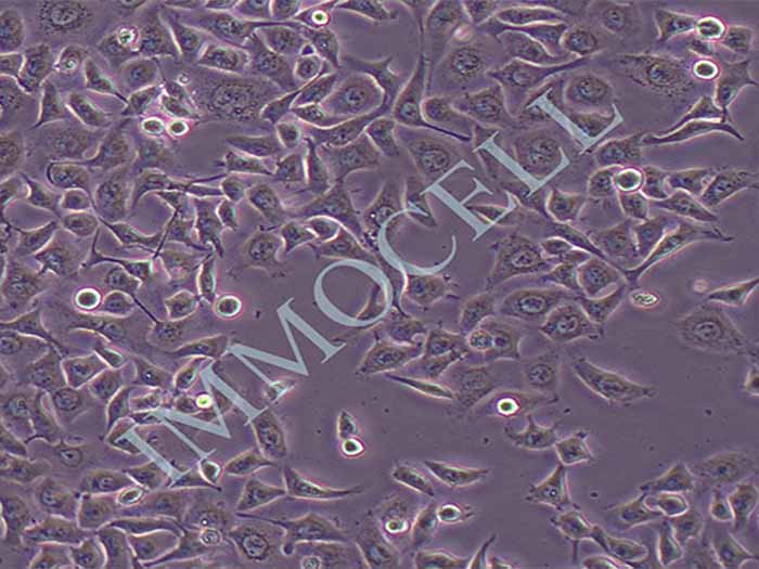 HNE1人鼻咽癌细胞株（HeLa污染细胞系）