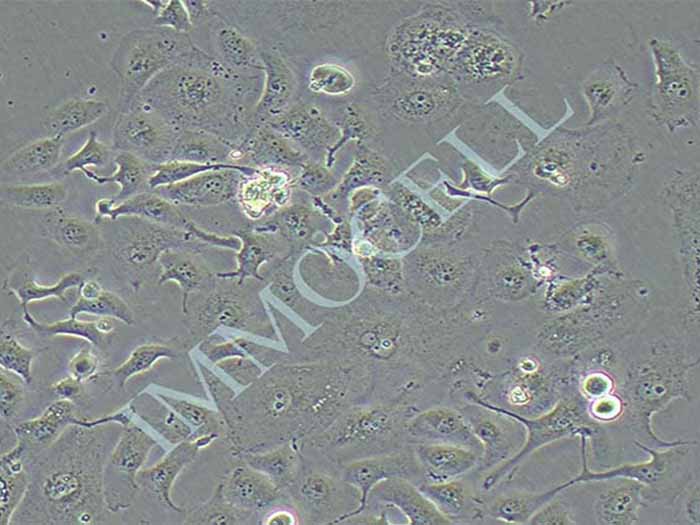 SUNE-1人低分化鼻咽癌细胞系（HELA污染系）