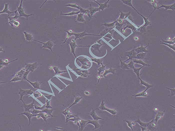 AD293人肾上皮细胞系（STR鉴定正确）